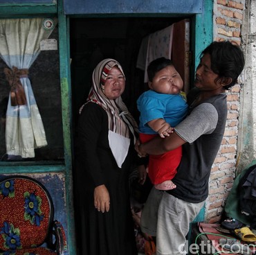 Minum SKM 6 Botol Sehari, Begini Kondisi Bayi Viral Berat 27 Kg Usai Diet
