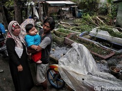 Bayi Obesitas 27 Kg dari Bekasi Dirujuk ke RSCM, Dapat Penanganan Multidisiplin