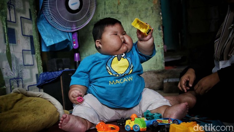 Kenzie Si Bayi Viral Obesitas, 1 Tahun Beratnya 27 Kg Viral bayi bernama Kenzie, punya bobot 27 kilogram di usia satu tahun. Ibunda Kenzie, Pitriah mengungkapkan berat badan anaknya memang berlebih sejak ia lahir.
Akibat obesitas yang dialaminya, tumbuh kembang Kenzie terganggu. Tidak seperti bayi seusianya, Kenzie belum bisa berdiri tegak.
