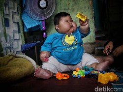Kondisi Bayi Obesitas 27 Kg di Bekasi, Setahun Belum Bisa Ngomong-Berjalan