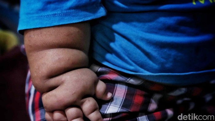 Viral Bayi Usia 16 Bulan Punya Bobot 27 Kg, Ini Hal Penting yang Perlu Diingat Kembali oleh Para Orang Tua