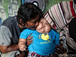 Viral Bayi Setahun Bobotnya Sampai 27 Kg di Bekasi, Ortu Buka Suara