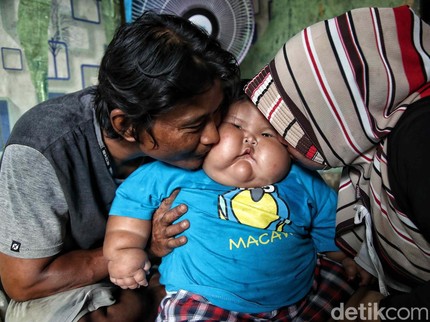 Sedihnya Ibunda Kenzie Anak Obesitas Bekasi, Drop Lihat Hujatan & Komentar Menyakitkan