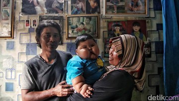 MINUM SUSU FORMULA HINGGA SUSU KENTAL MANIS