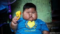 7 Potret Kenzie Asal Bekasi, Bayi Obesitas Berbobot 27 Kg di Usia 16 Bulan