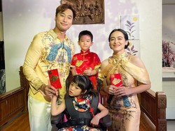 Perkembangan Putri Jevier Justin dan Tiffany Justin yang Idap Cerebral Atrophy