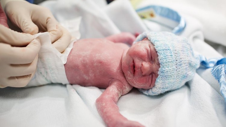 Vernix Caseosa Vernix Caseosa