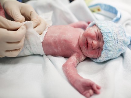 Vernix Caseosa Lapisan Putih yang Menyelimuti Bayi Saat Lahir, Apakah Berbahaya?