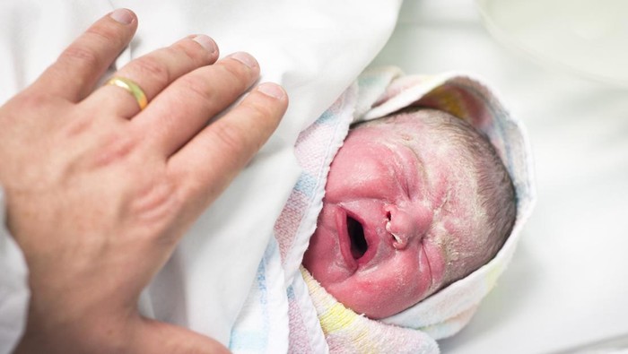 Vernix Caseosa