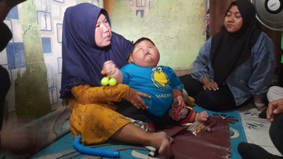 Bayi Obesitas di Bekasi Akan Jalani Program Penurunan Berat Badan