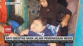 VIDEO: Bayi Obesitas Akan Jalani Pemeriksaan Medis