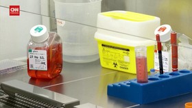 VIDEO: Transplantasi Sel Punca Kembali Sembuhkan Pasien HIV