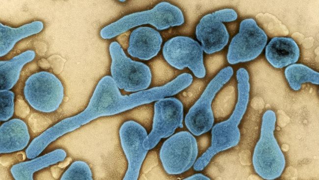 Virus Marburg saat ini tengah jadi ancaman di kawasan Afrika. Meski belum terdeteksi di Indonesia, sebaiknya kenali cara penularan virus Marburg.