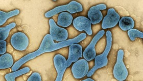 Kenali Cara Penularan Virus Marburg, Tak Cuma Lewat Cairan Tubuh