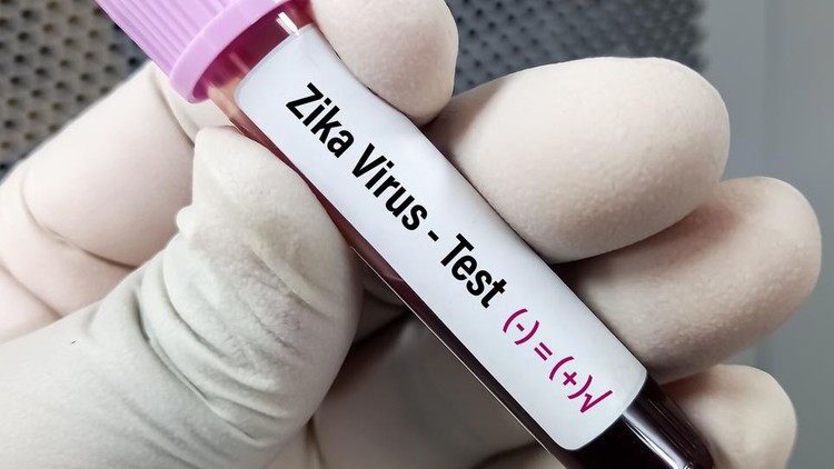 Ilustrasi Virus Zika