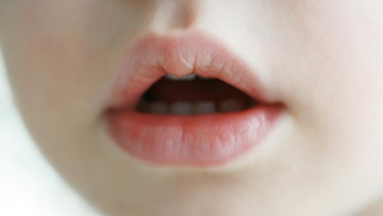 Stomatitis pada Bayi: Penyebab, Gejala, Pencegahan, dan Pengobatannya Stomatitis pada Bayi: Penyebab, Gejala, Pencegahan, dan Pengobatannya