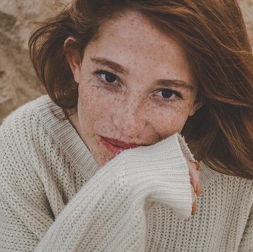 4 Cara Atasi Masalah Hiperpigmentasi pada Kulit Wajah