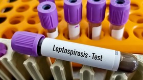 Bisa Menular Lewat Banjir, Apa Itu Leptospirosis?