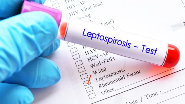 Leptospirosis merupakan penyakit yang rentan muncul saat musim hujan terutama di kawasan yang terendam banjir.