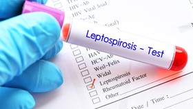 Diduga Penyebab Nelayan Tewas di Merak, Apa Itu Leptospirosis?
