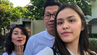 7 Potret Tara Anak Becky Tumewu Jadi Dokter Gigi yang Jarang Tersorot 