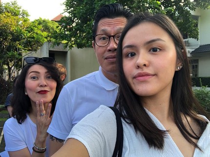 7 Potret Tara Anak Becky Tumewu Jadi Dokter Gigi yang Jarang Tersorot