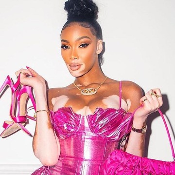 Deretan Perempuan dengan Vitiligo yang Punya Karier Gemilang Sebagai Model, Ada yang dari Indonesia!