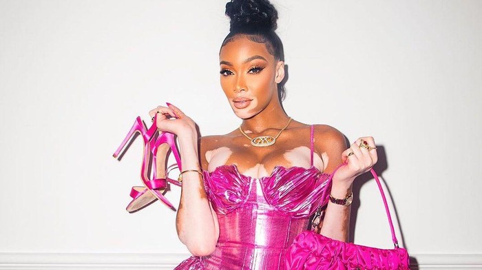 img-title Deretan Perempuan dengan Vitiligo yang Punya Karier Gemilang Sebagai Model, Ada yang dari Indonesia!