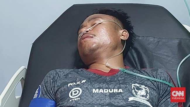 Dokter Madura United Marcello Araujo berharap ambulans yang disediakan di lapangan jangan seperti layaknya taksi usai insiden Ricki Ariansyah kolaps di Liga 1.