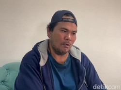 Fahmi Bo Hidup Sendiri Saat Sakit Diabetes, Harap Dijenguk Anak