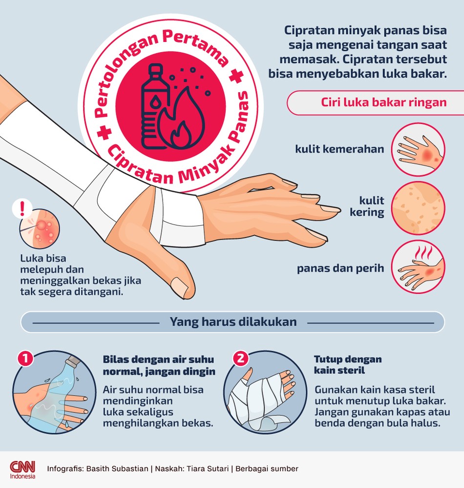 Cipratan minyak panas bisa menyebabkan luka bakar. Berikut pertolongan pertama terkena cipratan minyak panas.
