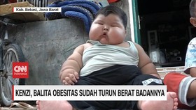 VIDEO: Kenzi, Balita Obesitas Sudah Turun Berat Badannya