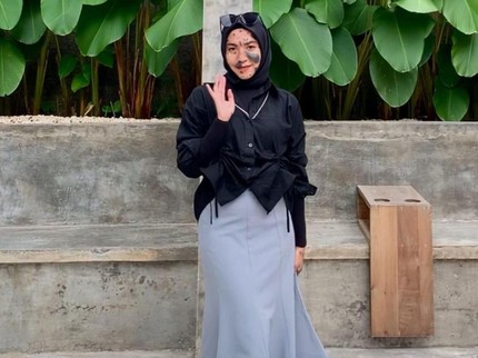 Punya Banyak Tanda Lahir, Wanita Ini Pede & Enggan Operasi karena Pesan Ibunda
