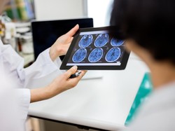 Singapura Punya Brain Bank, Kumpulkan Otak dari Donor Manusia untuk Diteliti