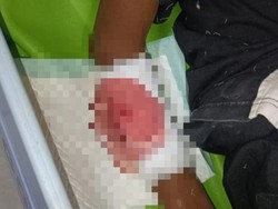 7 Fakta Insiden Berdarah Bocah SD di Blitar Dibacok Teman Saat Main Bola