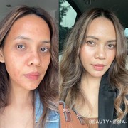 Beaupicks: Mencegah Penuaan Dengan Mencoba Perawatan Salmon DNA yang Populer