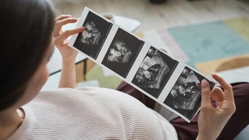 PENYEBAB PERUT IBU HAMIL KECIL