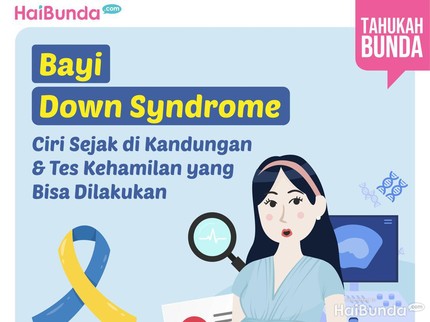 Bayi Down Syndrome: Ciri Sejak di Kandungan & Tes Kehamilan yang Bisa Dilakukan