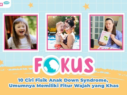 10 Ciri Fisik Anak Down Syndrome, Umumnya Memiliki Fitur Wajah yang Khas