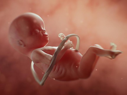 3 Posisi Bayi Sungsang dan Cara Membetulkan Posisi Janin agar Bisa Lahiran Normal