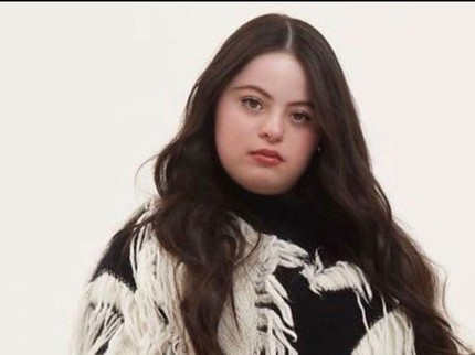 Hari Down Syndrome Sedunia, Ini 5 Tokoh Inspiratif Penyandang Down Syndrome