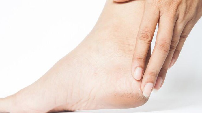 Tumit Pecah-Pecah Mengganggu Penampilan dan Percaya Dirimu? Ini 4 Rekomendasi Pelembab Agar Lebih Terhidrasi