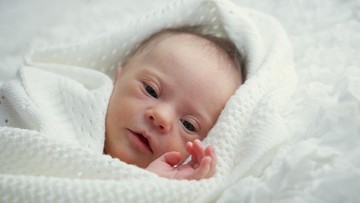 PENYEBAB ANAK DOWN SYNDROME MILIKI WAJAH MIRIP