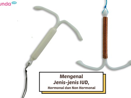 Mengenal Jenis-jenis IUD, Hormonal dan Non Hormonal