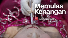 Kolong Kota: Memulas Kenangan