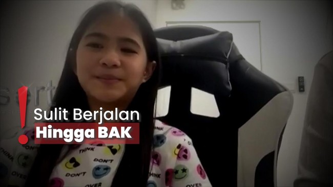 Lumpuh Gegara Prank Tarik Kursi, Puteri Rafaysa Berjuang untuk Sembuh