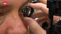VIDEO: Kesehatan Mata Dapat Diagnosis Penyakit Alzheimer