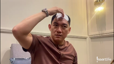 Tak Ada Gejala, Ifan Seventeen Tak Sadar Idap Tumor Kepala