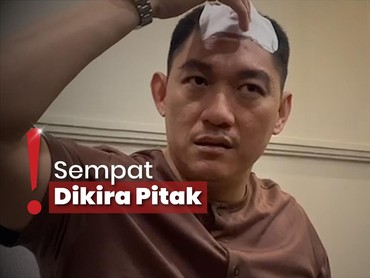 img-title Kronologi Ifan Seventeen Idap Tumor di Kepala hingga Harus Operasi