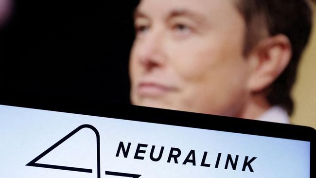 Terobosan Brilian Elon Musk: Chip Otak Tanam Membuat Sejarah Baru bagi Manusia!